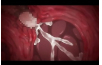 Thumbnail of post image 041